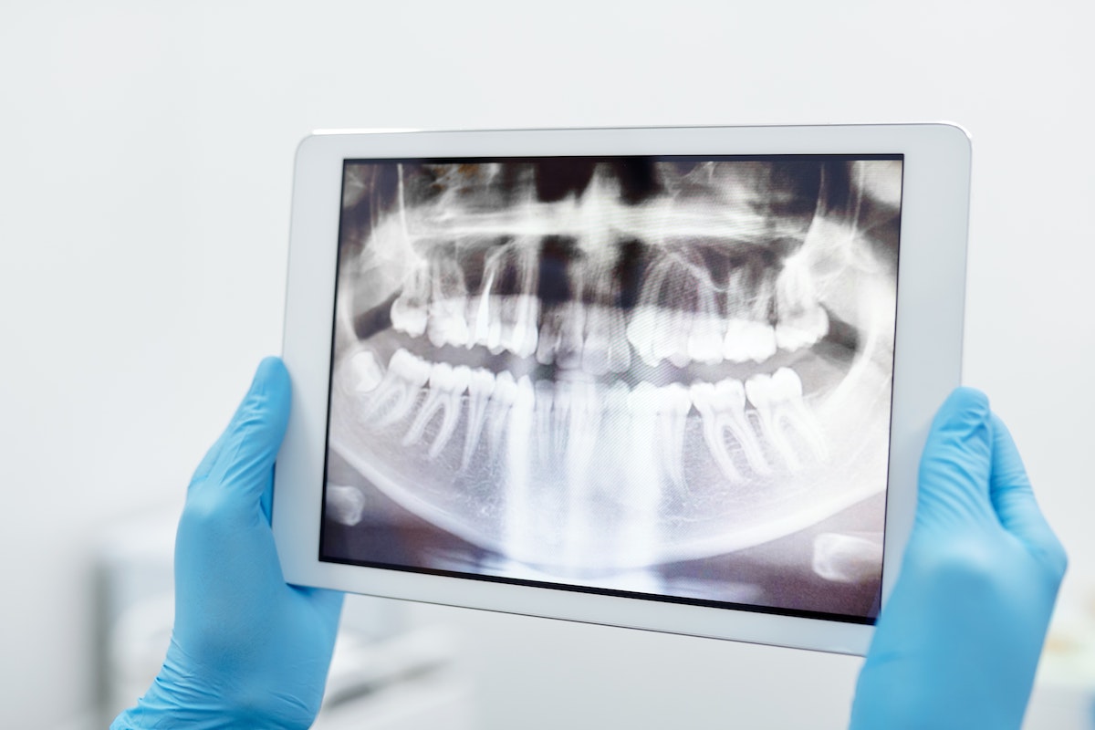 Chirurgia Dentale Guidata AKOS Dental Care Parma Carpi Modena Reggio Emilia | Eccellenze in Chirurgia Orale e Implantologia