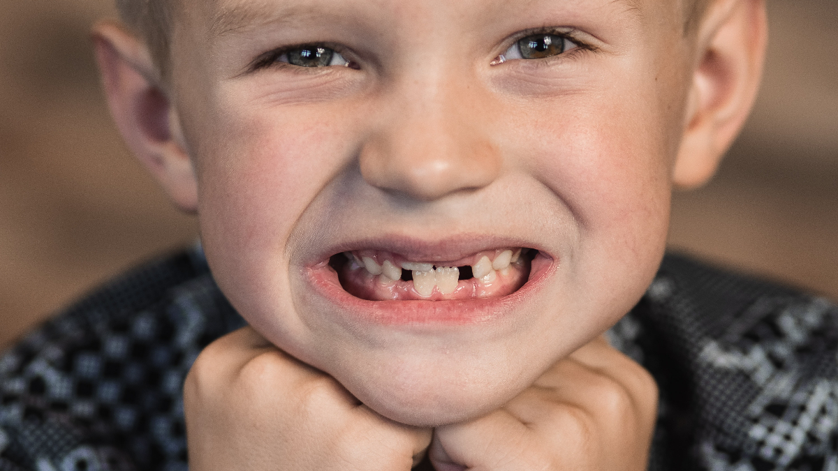 Quando si mette l'apparecchio ai denti ai bambini? - Studio Dentistico  Piras Denotti