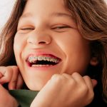 Allineatori Dentali per bambini AKOS Dental Care | Centro Odontoiatrico Parma Piacenza Casalmaggiore Fidenza Cremona