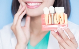 Impianti Dentali: La Soluzione Ideale per un Sorriso Naturale e Duraturo