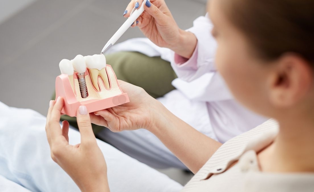 Impianti Dentali a Parma e Casalmaggiore: Come Scegliere il Centro Odontoiatrico Giusto