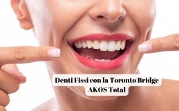 Ecco come ottenere Denti Fissi con la Toronto Bridge AKOS Total: La Soluzione Definitiva