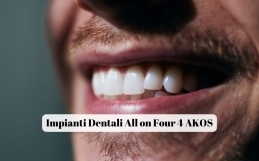 Impianti Dentali All on Four 4 AKOS: La Migliore Alternativa alla Dentiera